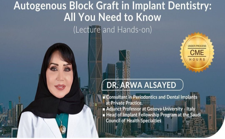 Autogenous Block Graft in Implant Dentistry: All You Need to Know